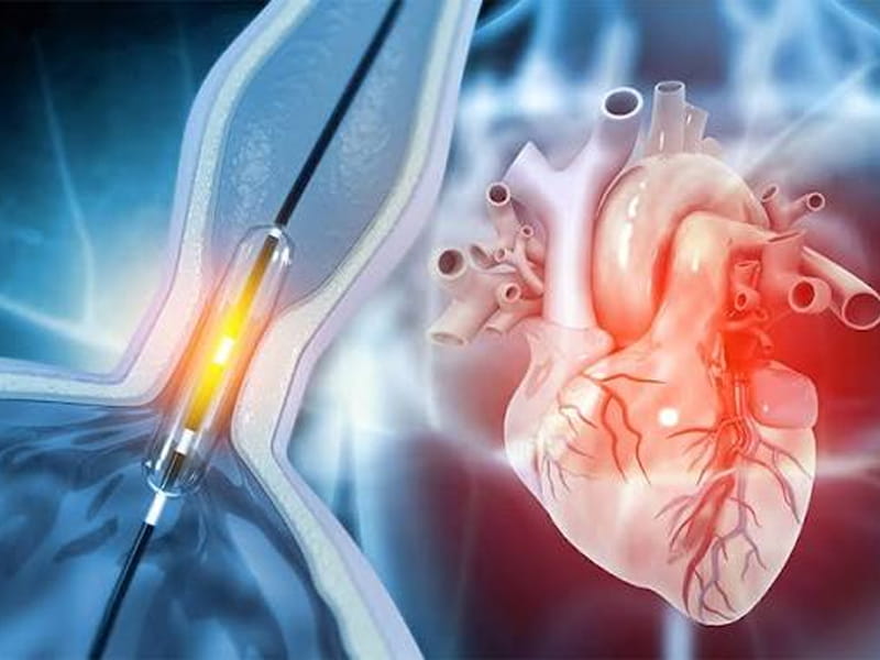 Cardiology Treatment